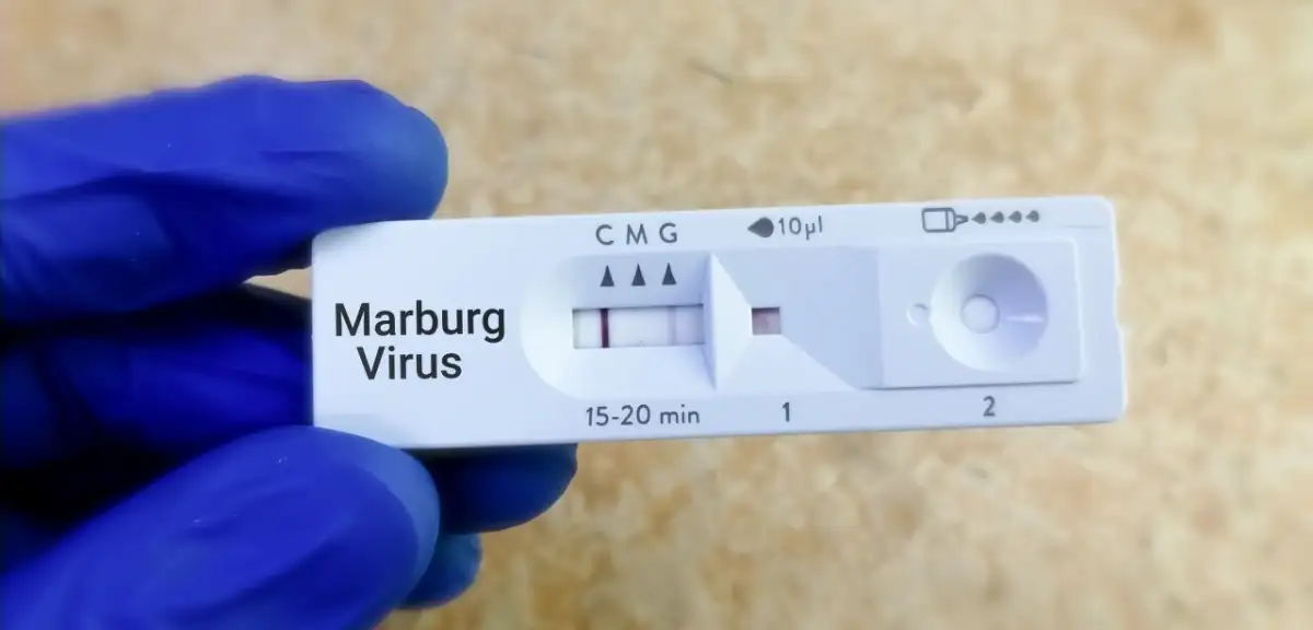 Marburg Virüsü Salgını Sona Erdi