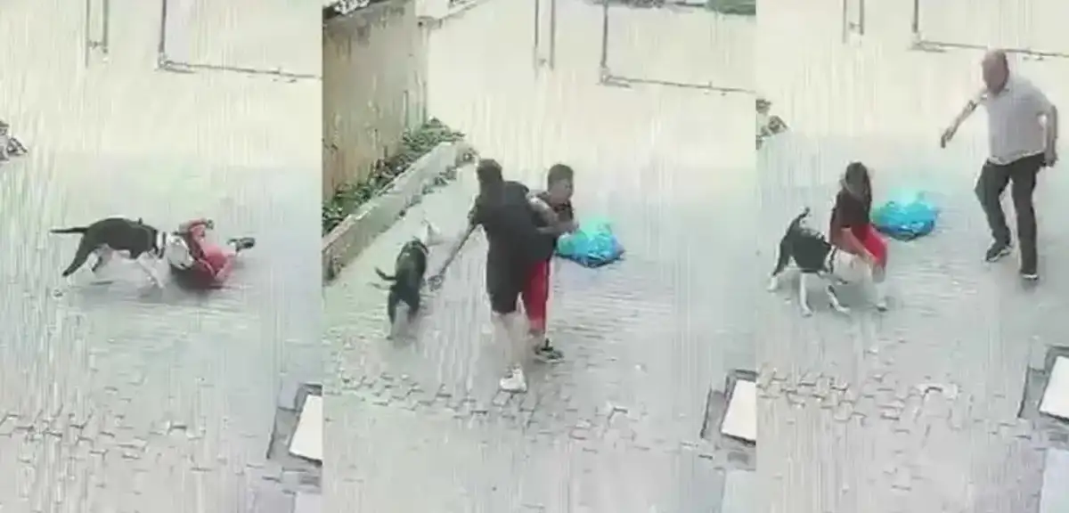 Ataşehir'de Pitbull Dehşeti: Sokakta Oynayan Çocuğa Saldırdı