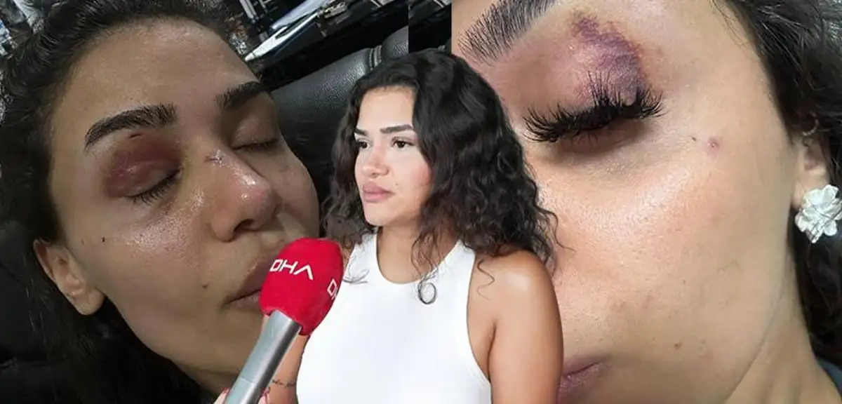 Ebru hemşire eski sevgilisinden koruma istedi: Ölmeden sesimi duyun