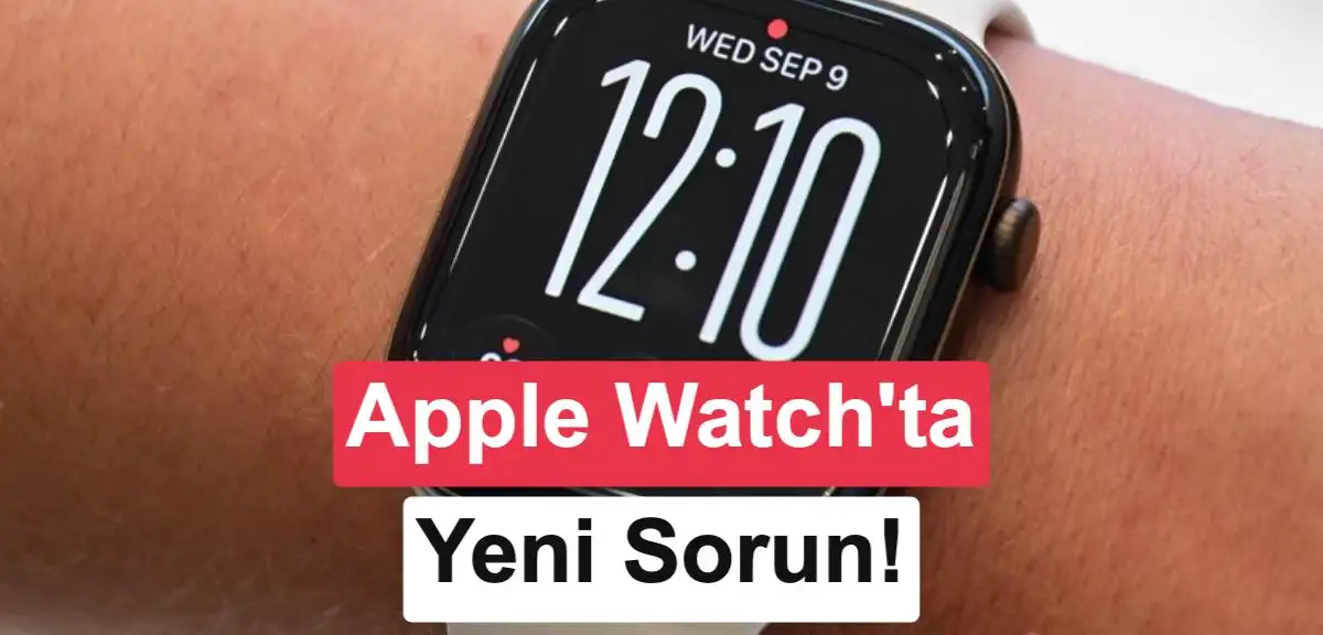 Yeni Apple Watch'lar cildi tahriş ediyor: Şikayetler artıyor!