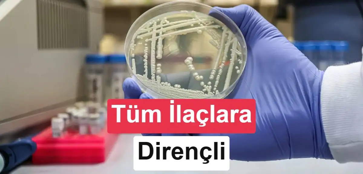 Tüm mantar ilaçlarına dirençli ölümcül mantar Kenya'da tespit edildi