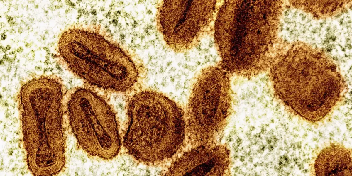 DSÖ, 1 Yaşından Büyük Çocuklara Yönelik İlk Mpox Aşısını Onayladı