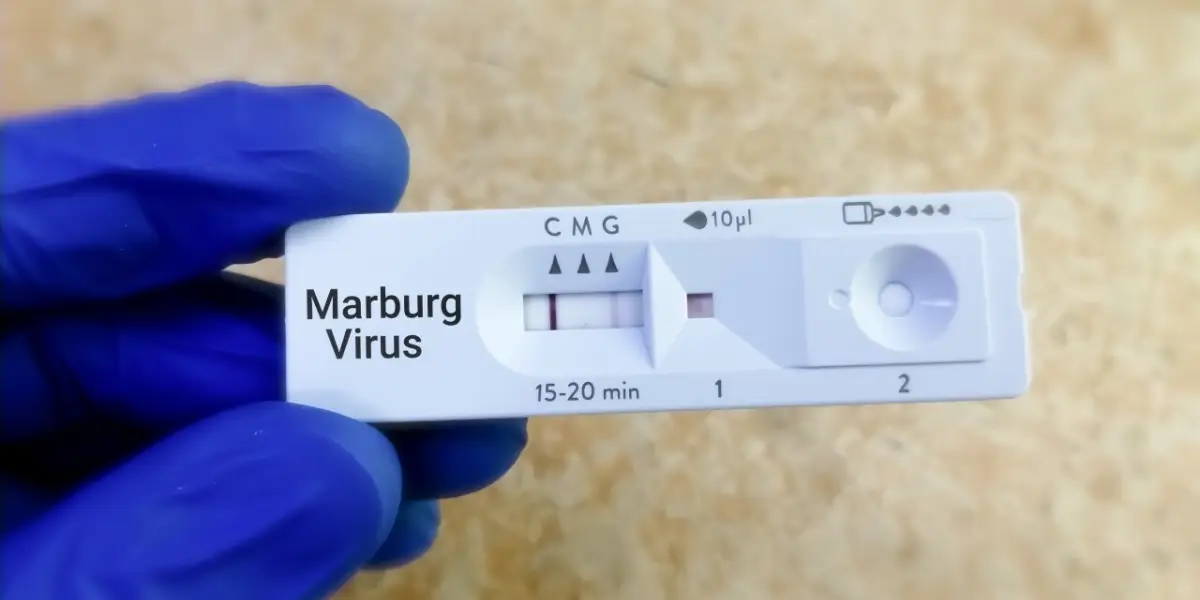 Marburg Virüsü Salgını Sona Erdi
