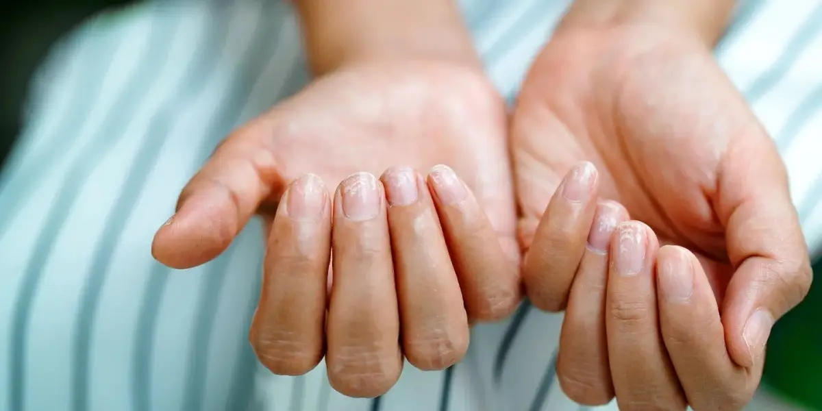 Yorgunluğunuzun Sebebi Vitamin Eksikliği Olabilir