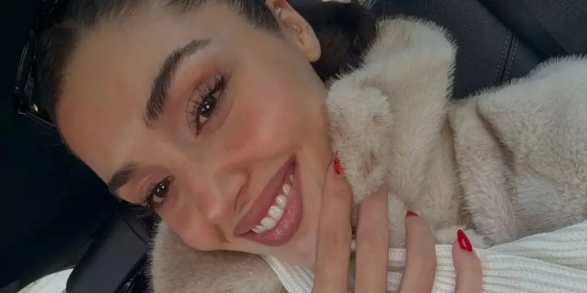 Hande Erçel'in Yüzüne Ne Oldu? Estetik mi Yaptırdı?