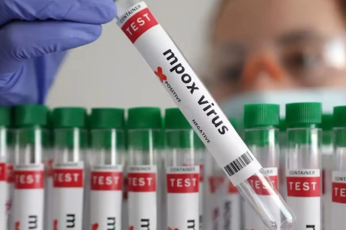 Almanya'da Mpox Virüsünün Yeni Varyantı Tespit Edildi