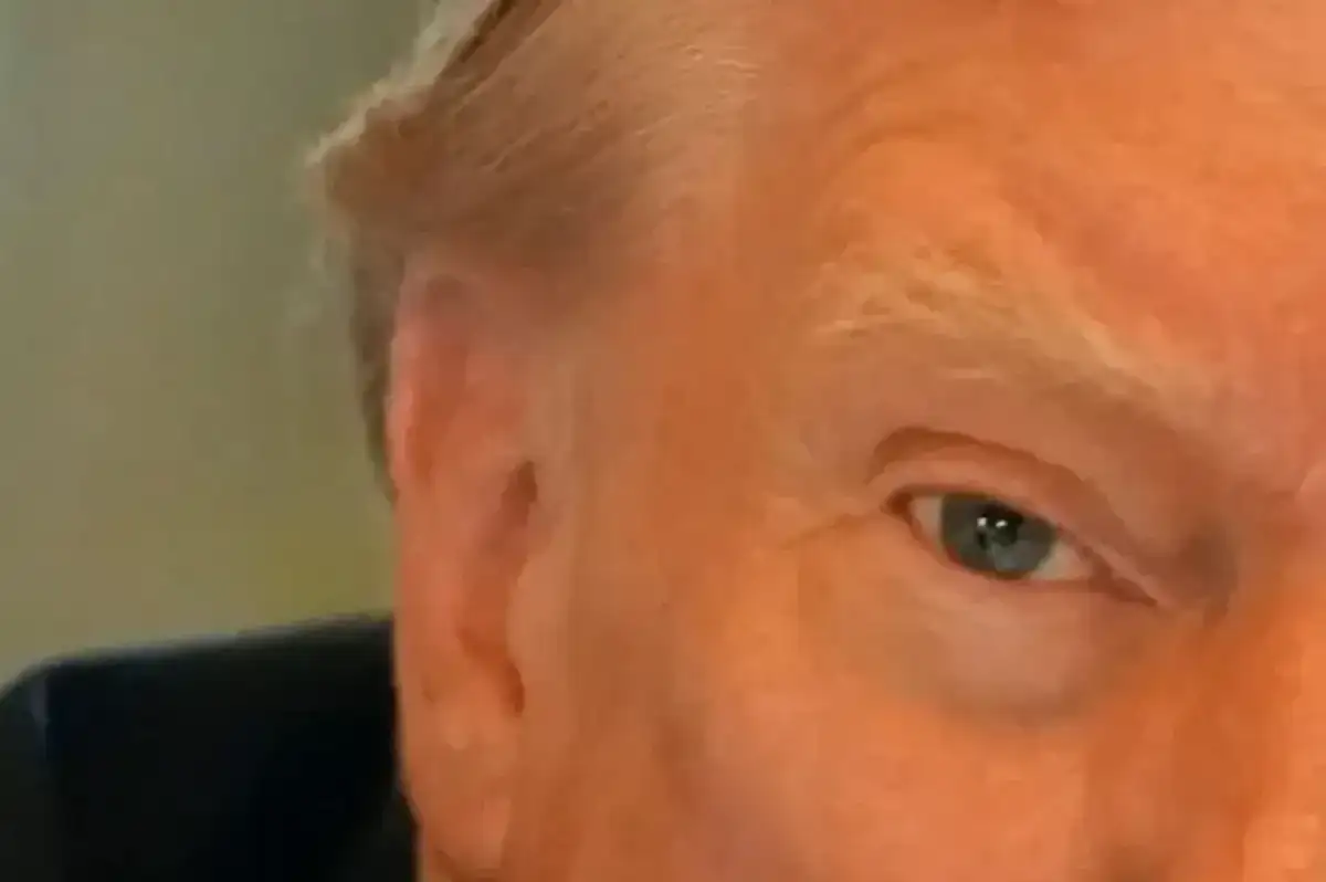 Donald Trump Bandajı Çıkardı! Nasıl Bu Kadar Hızlı İyileşti?