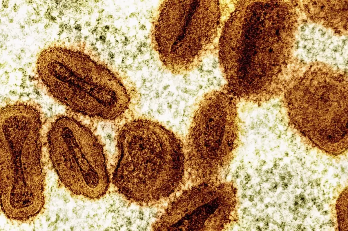 DSÖ, 1 Yaşından Büyük Çocuklara Yönelik İlk Mpox Aşısını Onayladı