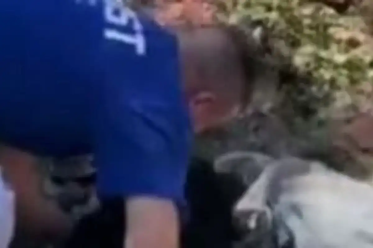 Mama Verdiği Köpek Burnundan Isırdı! Korkunç Olay