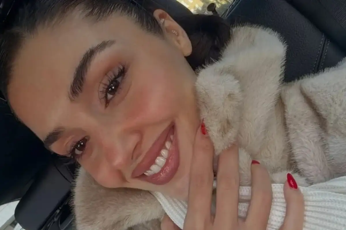 Hande Erçel'in Yüzüne Ne Oldu? Estetik mi Yaptırdı?