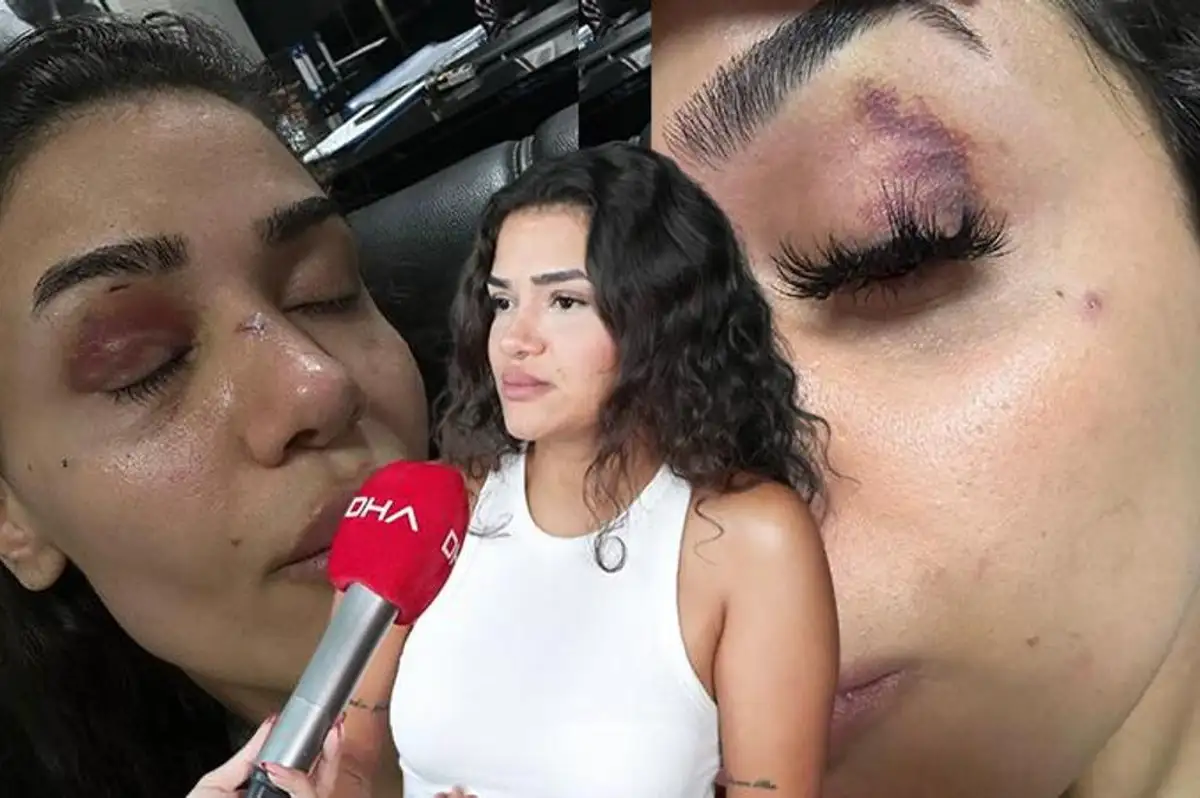 Ebru hemşire eski sevgilisinden koruma istedi: Ölmeden sesimi duyun