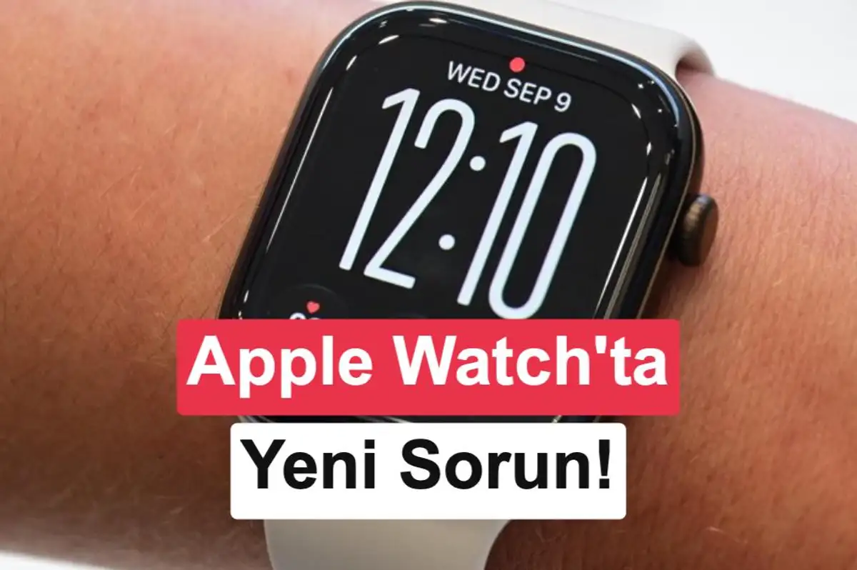 Yeni Apple Watch'lar cildi tahriş ediyor: Şikayetler artıyor!