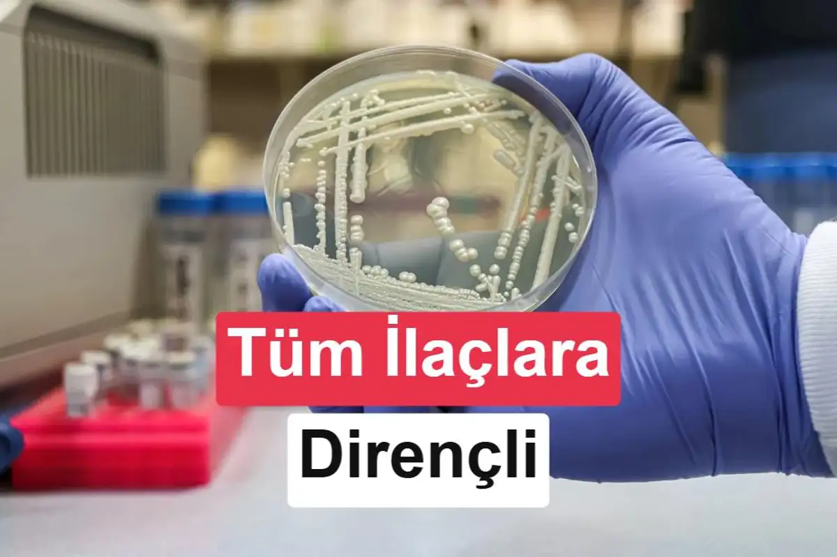 Tüm mantar ilaçlarına dirençli ölümcül mantar Kenya'da tespit edildi