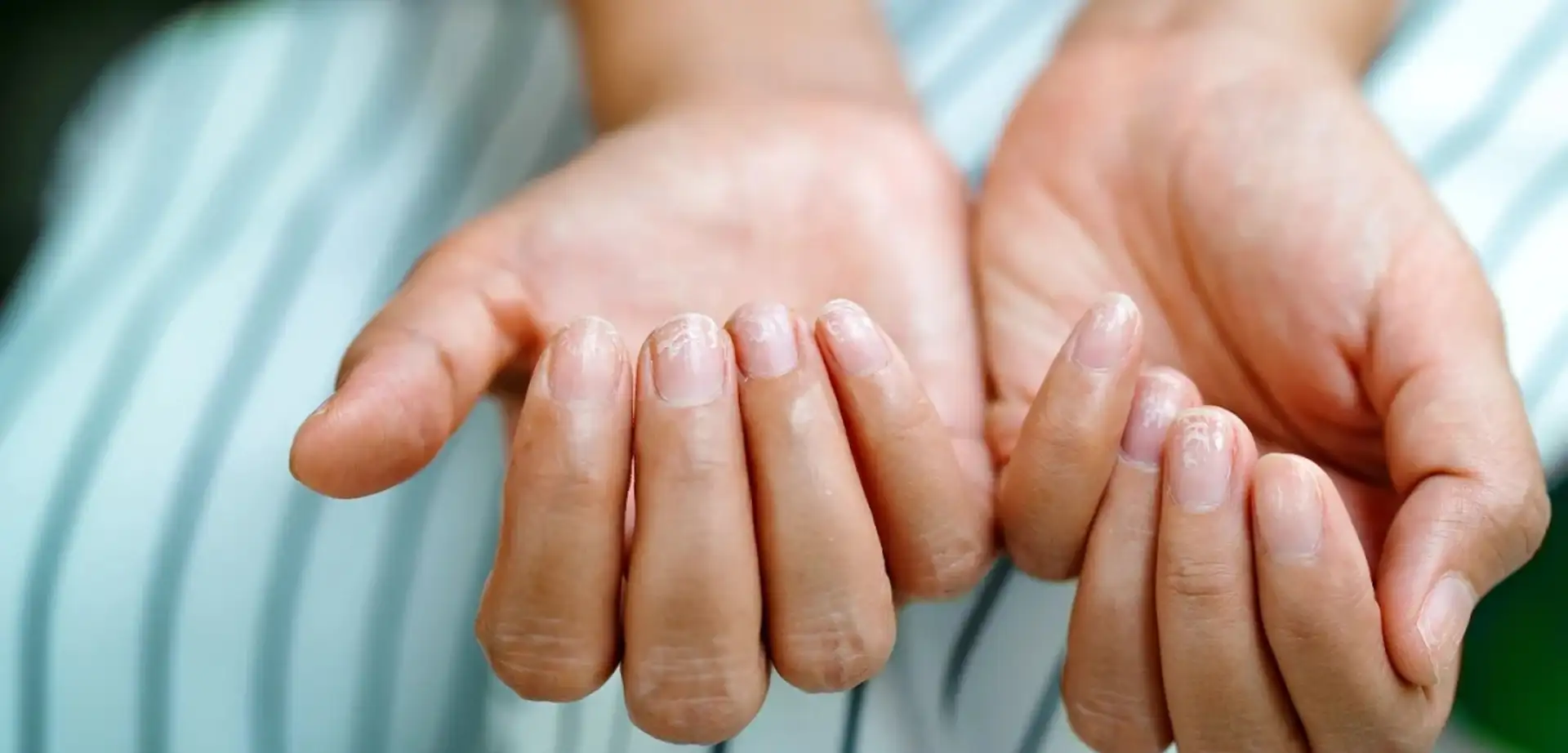 Yorgunluğunuzun Sebebi Vitamin Eksikliği Olabilir