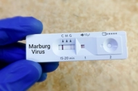 DSÖ Açıkladı: Marburg Virüsü Salgını Sona Erdi