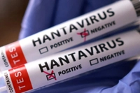 ABD'de Gemide Hantavirüs Alarmı! Hantavirüs Nedir, Belirtileri Nelerdir?