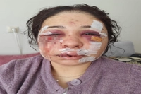 Boşanma sürecindeki eşini darbeden polis memuru o ifadeler sonrası tahliye edildi