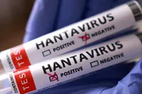 Gemi Tahliyesi Tamamlandı: Hantavirüs Testleri Negatif Çıktı