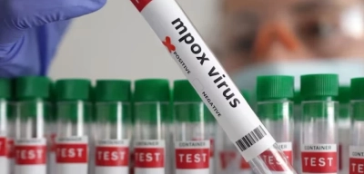 Almanya'da Mpox Virüsünün Yeni Varyantı Tespit Edildi