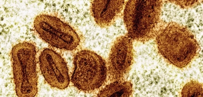DSÖ, 1 Yaşından Büyük Çocuklara Yönelik İlk Mpox Aşısını Onayladı