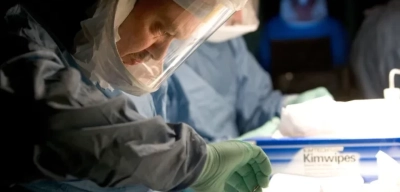 Marburg Virüsü Nedir? Ebola Benzeri Marburg Virüsü Belirtileri Neler?