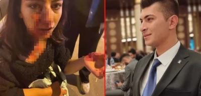 Melih Ünlüer Kimdir? Bir Kadını Darp Edip Serbest Bırakılan AKP'li Ünlüer Görevden Alındı!