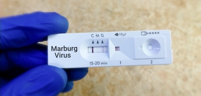 Marburg Virüsü Salgını Sona Erdi