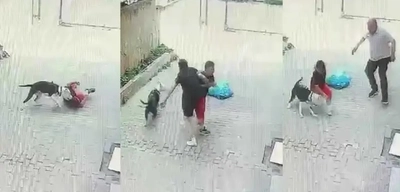 Ataşehir'de Pitbull Dehşeti: Sokakta Oynayan Çocuğa Saldırdı