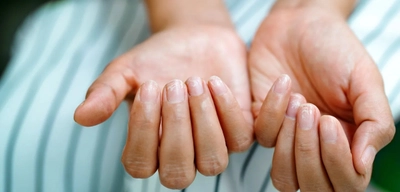 Yorgunluğunuzun Sebebi Vitamin Eksikliği Olabilir