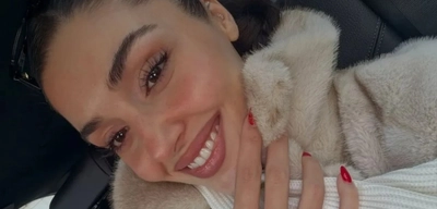 Hande Erçel'in Yüzüne Ne Oldu? Estetik mi Yaptırdı?