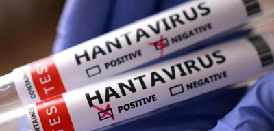 Hantavirüs Nedir, Belirtileri Nelerdir?
