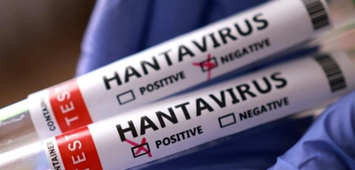 3 Vatandaşın Hantavirüs Testleri Negatif Çıktı
