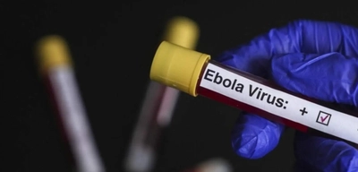 Ebola Krizinde Finansal Çıkmaz: O Ülkelerde Büyük Salgın Alarmı!