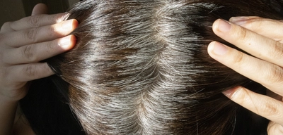 Beyaz saçlar için mucize çözüm! Uzmanlar öneriyor: Her gün 1 tane tüketin ve etkisini görün…