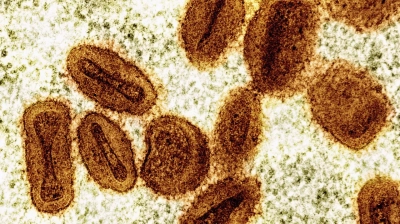 DSÖ, 1 Yaşından Büyük Çocuklara Yönelik İlk Mpox Aşısını Onayladı