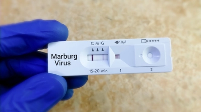 DSÖ Açıkladı: Marburg Virüsü Salgını Sona Erdi