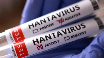 ABD'de Gemide Hantavirüs Alarmı! Hantavirüs Nedir, Belirtileri Nelerdir?