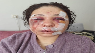Boşanma sürecindeki eşini darbeden polis memuru o ifadeler sonrası tahliye edildi