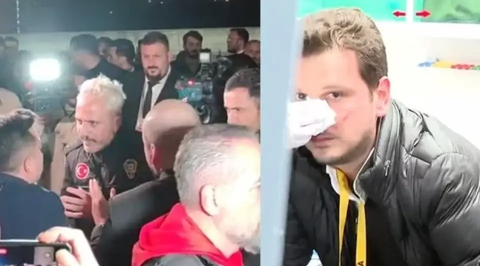 Hasan Arat'ın Şoförü Derbi Sonrası Gazeteciye Saldırdı: Gözaltına Alındı!