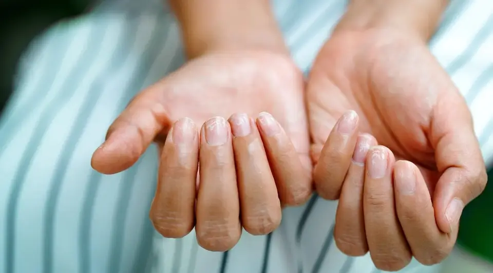 Yorgunluğunuzun Sebebi Yoğun Tempo Değil, Vitamin Eksikliği Olabilir!