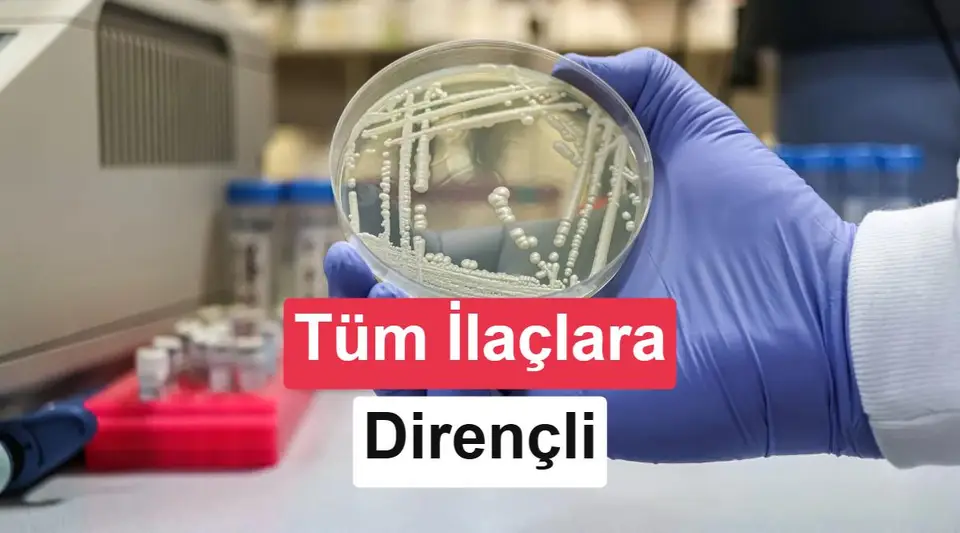 Tüm mantar ilaçlarına dirençli ölümcül mantar Kenya'da tespit edildi