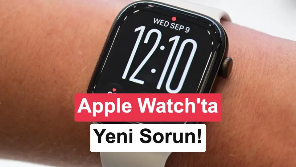 Yeni Apple Watch'lar cildi tahriş ediyor: Şikayetler artıyor!