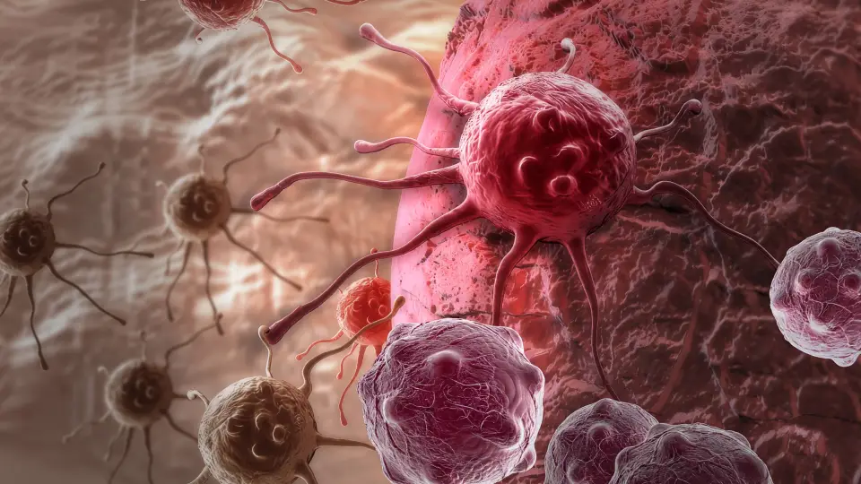 50 yaşın altında görülen kanser vakalarındaki artış var